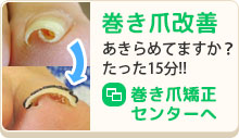 巻き爪矯正センター
